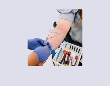 Lab test