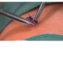 Stitches Removal