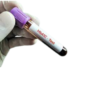 HbA1c